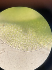 Solenostoma gracillimum