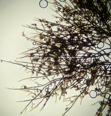 Trichaleurina tenuispora