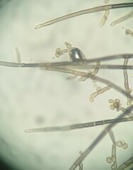 Trichaleurina tenuispora