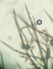 Trichaleurina tenuispora