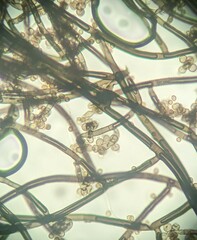 Trichaleurina tenuispora