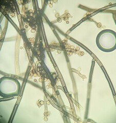 Trichaleurina tenuispora