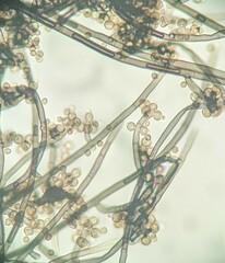 Trichaleurina tenuispora