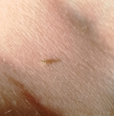 Auchenorrhyncha