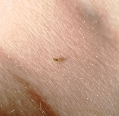 Auchenorrhyncha