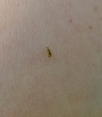 Auchenorrhyncha