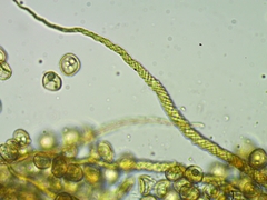 Trichia crateriformis