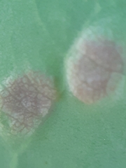 Aceria varia