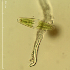 Closterium navicula