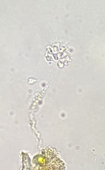 Anthophysa vegetans