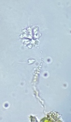 Anthophysa vegetans
