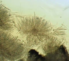 Erioscyphella abnormis