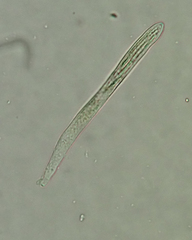 Erioscyphella abnormis