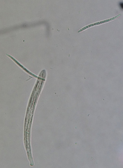 Erioscyphella abnormis