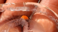 Peachia quinquecapitata