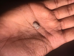 Gonocephalum simplex