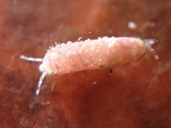 Caecum