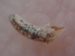 Caecum