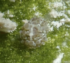 Bunodeopsis globulifera
