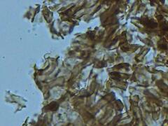 Dendrophora versiformis