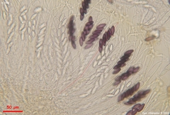 Ascobolus furfuraceus