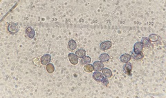 Melanoleuca angelesiana