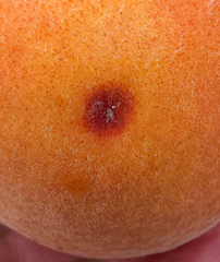 Quadraspidiotus perniciosus