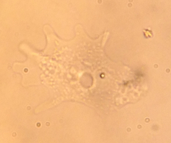 Amoeba