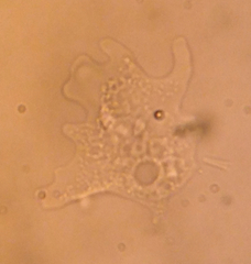 Amoeba