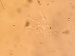 Amoeba