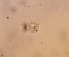 Acanthocystis
