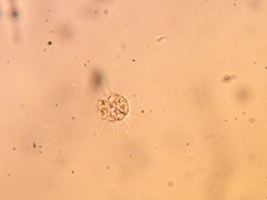 Acanthocystis