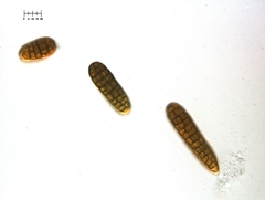 Berkleasmium concinnum