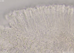 Orbilia xanthostigma