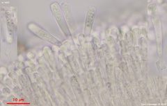 Orbilia xanthostigma