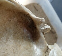 Ortmanniana ligamentina