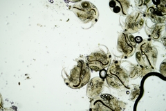 Bosmina longirostris