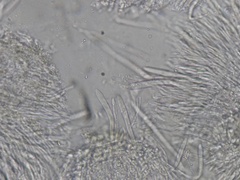 Coccomyces dentatus
