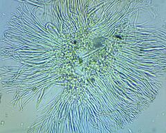 Coccomyces dentatus