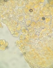 Puccinia cymbiformis