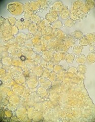 Puccinia cymbiformis