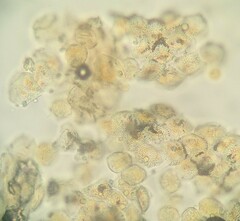 Puccinia cymbiformis