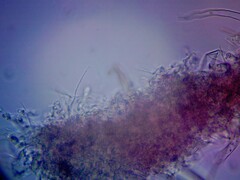Lophium mytilinum