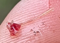 Lernaea