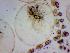 Noctiluca scintillans