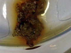 Stereocaulon sterile
