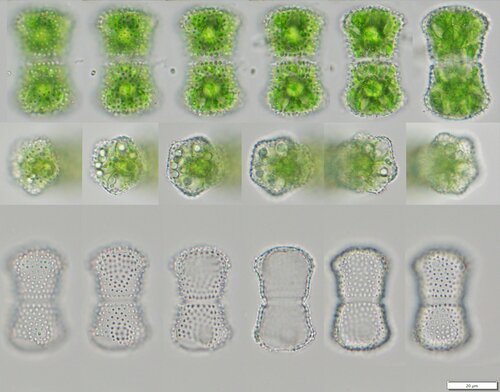 Staurastrum meriani