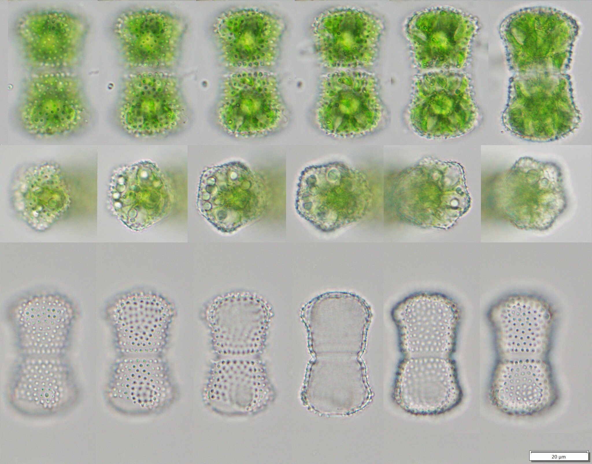 Staurastrum meriani