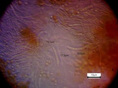 Chaenotheca hispidula