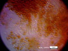 Chaenotheca hispidula